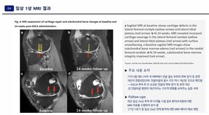 강스템바이오텍, OSCA 2a상 12개월 MRI 중간분석 확보...글로벌 기술수출... - 뉴스 썸네일 이미지